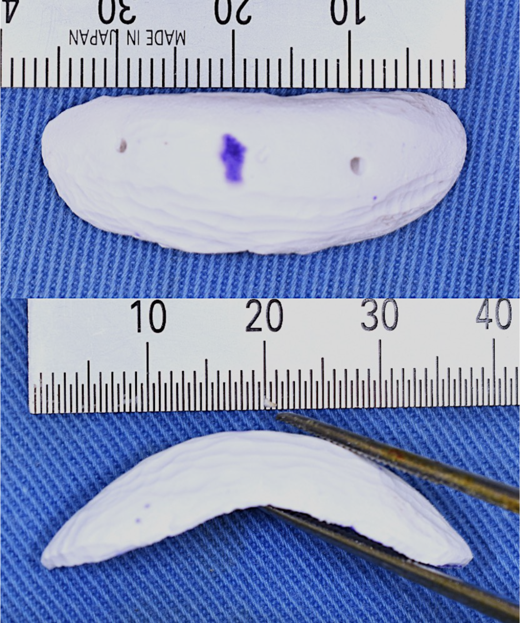 バイオペックス(人工骨 : ペースト状ハイドロキシアパタイト製剤)の実際の大きさ